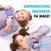 Elastici intermascellari per l'apparecchio: a cosa servono 🦷