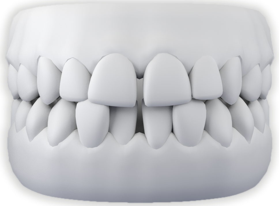 SPAZIO TRA I DENTI