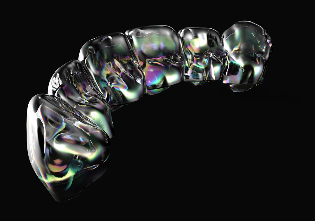 Aligner 1