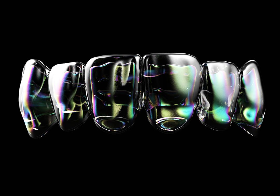 Aligner 4