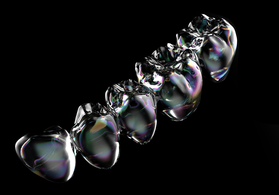 Aligner 5